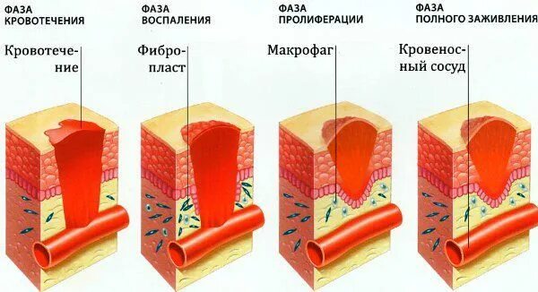 Сколько заживает глубокий. Процесс заживления раны. Заживление глубокой раны.