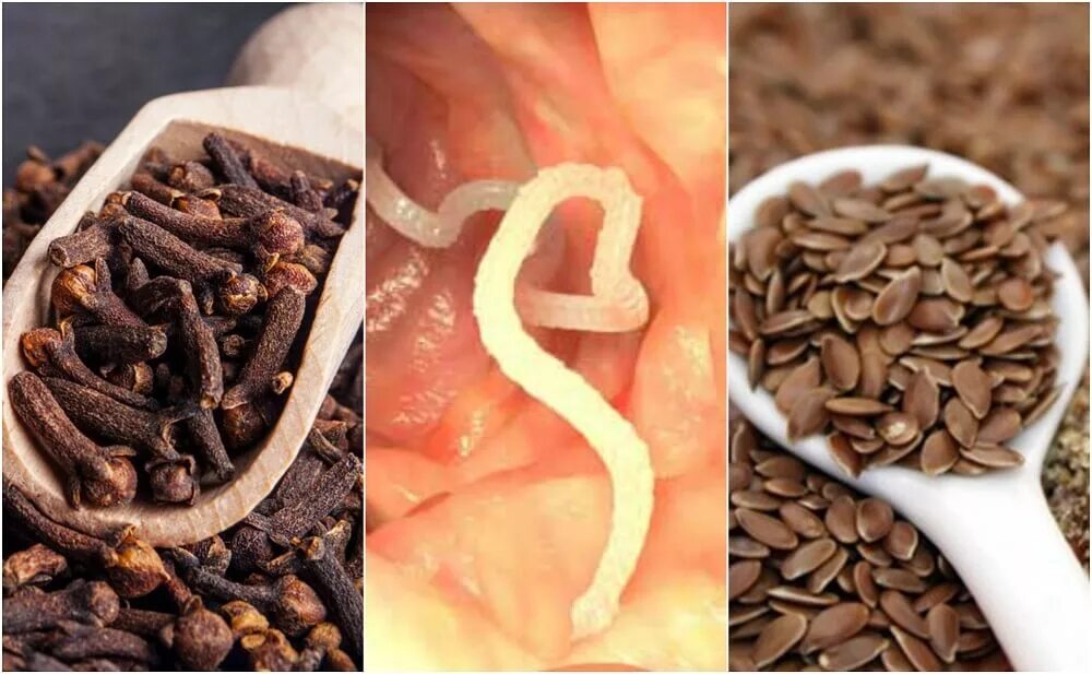 Белые черви аквариумные улитки. Избавление от паразитов. Анкилостома геогельминты. Как убрать червяков. Аквариумные паразиты черви.