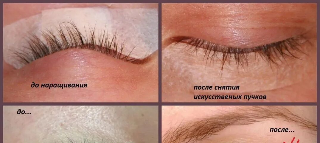 Что делать если нет ресниц. Ресницы после наращивания. ресницы после снятия нарощенных ресниц. ресницы после наращивани. свои ресницы после снятия нарощенных.