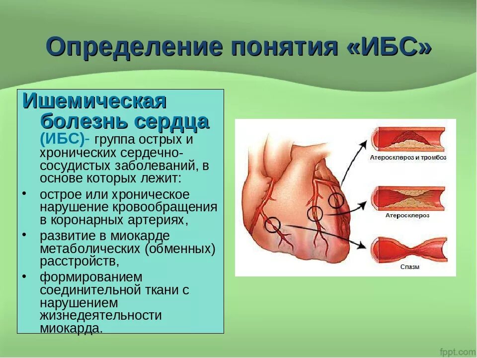 Ибс что это. Выявление ишемической болезни сердца. определение понятия ибс. ишемическая болезнь сердца определение.