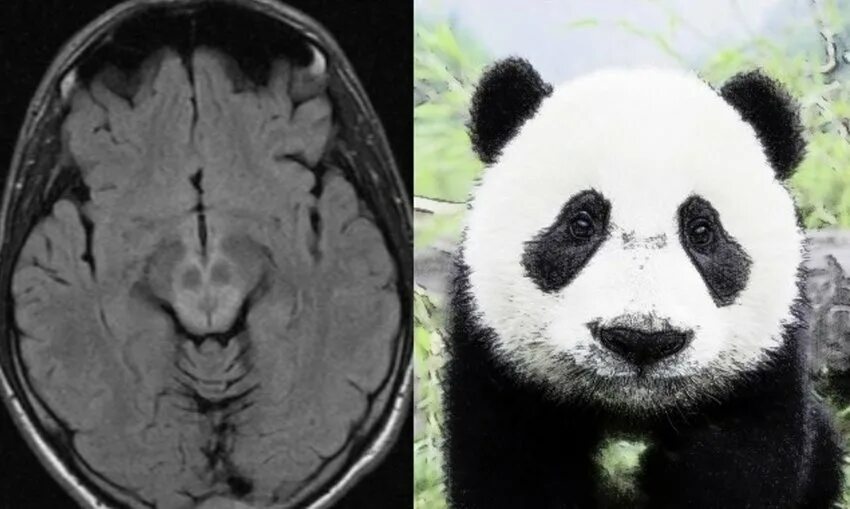 Панда собирает в круг. Лицо Панда под микроскопом. Двухголовая Панда. Смертельная Панда.