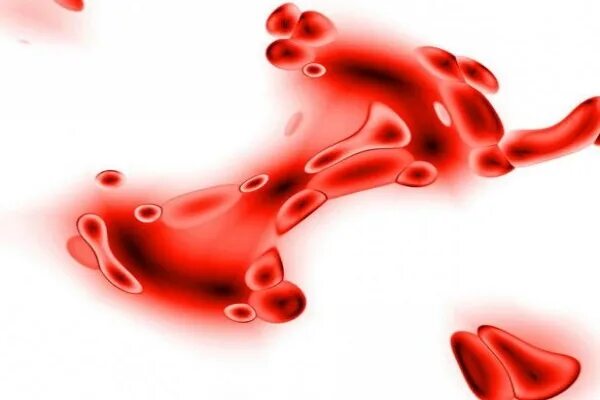 Патологическое кровотечение. Кровь из половых путей. Сгустки крови из половых путей. Межменструальная кровь.