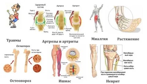 Болят суставы при инфекции