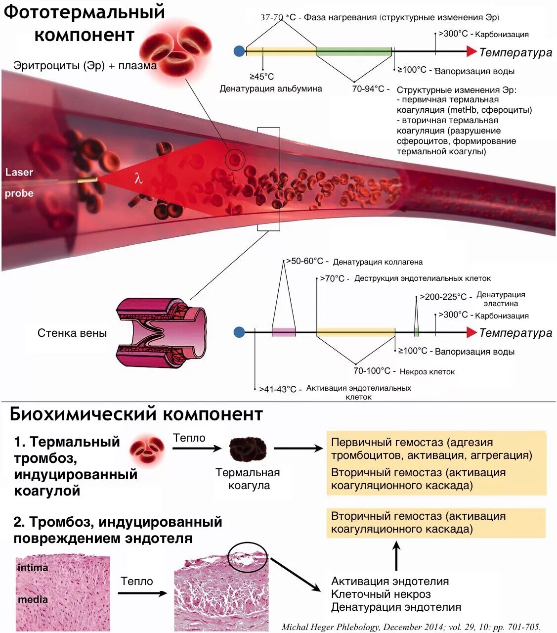Формирование тромба биохимия. Эндовазальная лазерная абляция. Эндовенозная лазерная коагуляция.