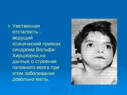 Вольфа хиршхорна