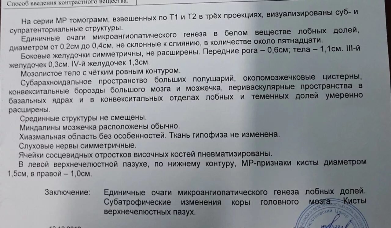 Кт отзывы врачей. Мрт мозга заключение. Компьютерная томография головного мозга заключение. Протокол мрт головного мозга. Результаты мрт головы.