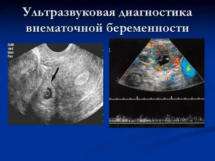 Яичник зародыш