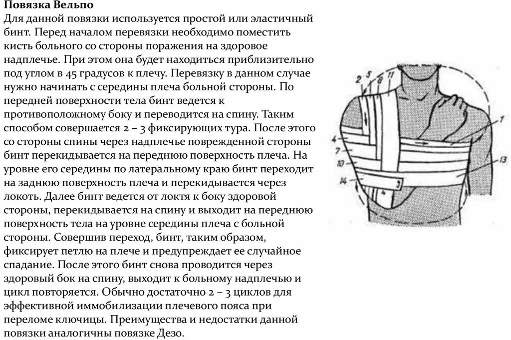 Дезо алгоритм. Показания к наложению повязки Вельпо. Повязка Вельпо техника наложения. Повязка Вельпо алгоритм наложения. Повязка Вельпо показания.