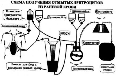 Переливание отмытых эритроцитов. Отмывание эритроцитов методика. системы для отмывания эритроцитов. отмытые эритроциты.