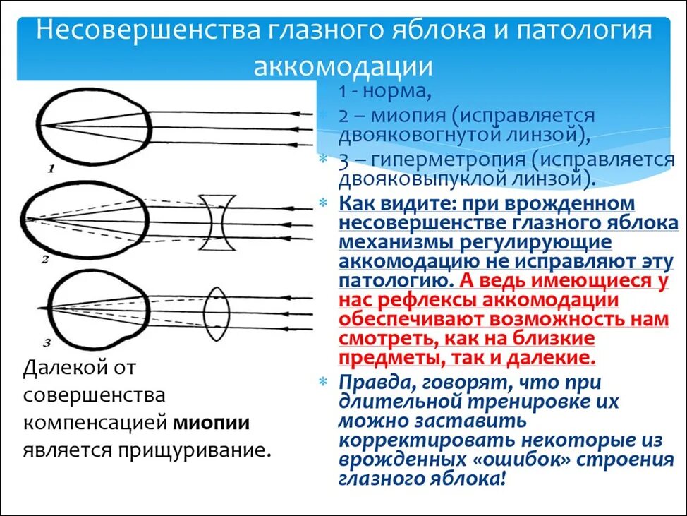 Патологическая миопия. Рефракция спазм аккомодации. паралич аккомодации глаза. миопия и спазм аккомодации. аккомодация близорукость и дальнозоркость.