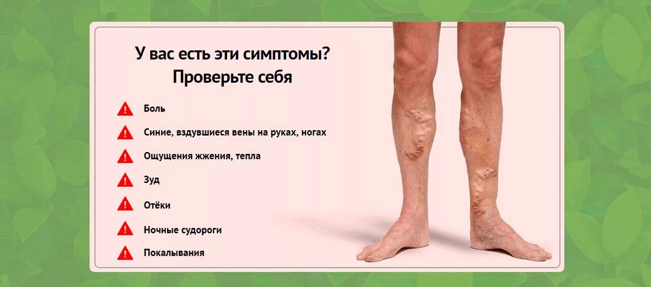 Почему ноги становятся ватными. Варикозное расширение вен нижних конечностей симптомы. Расширение вен на ногах причины.