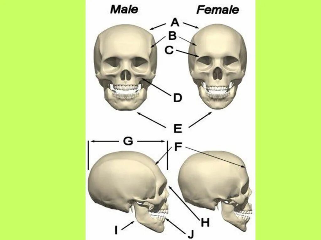 Варианты формы черепа. Женский череп анатомия. Отличие мужского и женского черепа. Форма человеческого черепа.