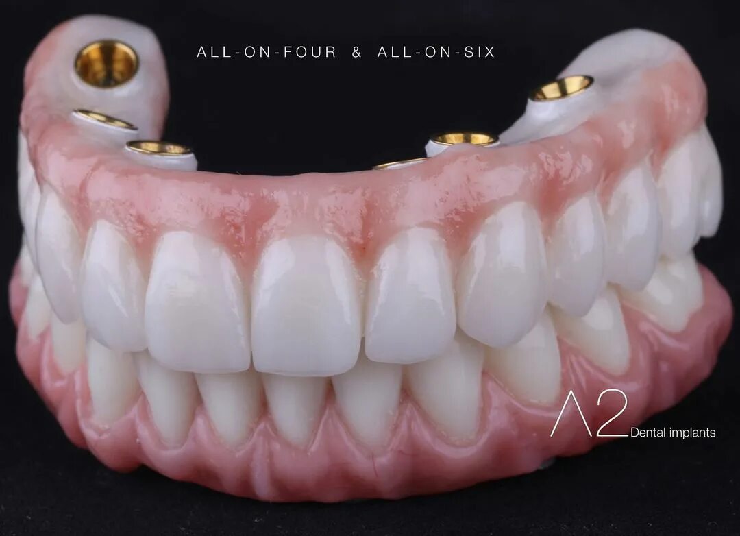 Que material es mejor para una prótesis dental