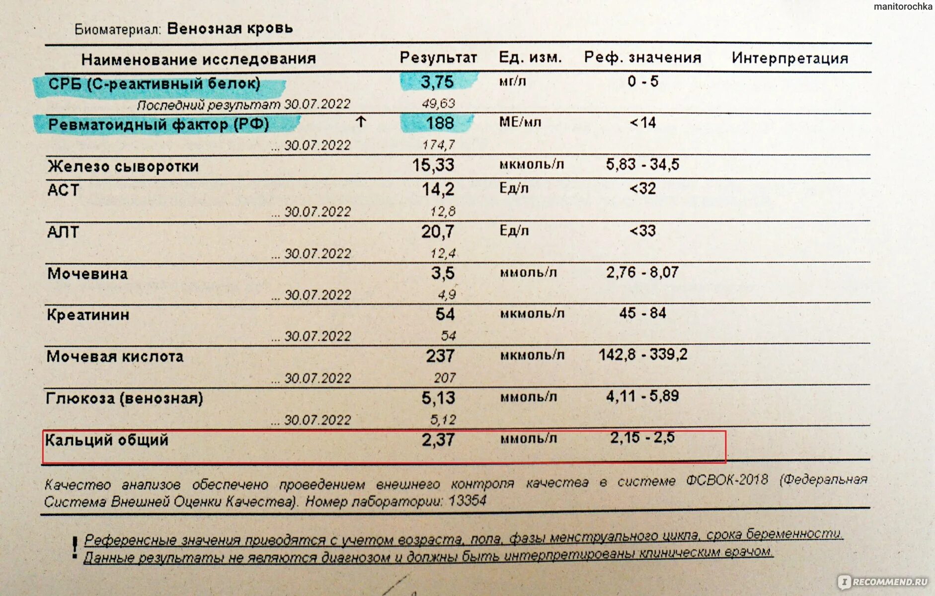 Кальций и фосфор в норме у детей. Фосфор норма у детей. Анализ на кальций ребенку. Анализ биохимия кальция норма. Анализ на кальций ребенку.