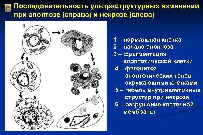 Последовательность изменения строения. Схема гибели клеток при некрозе и апоптозе. Изменение ядер клеток при некрозе. Изменение клетки при некрозе схема. Некроз клетки схема.