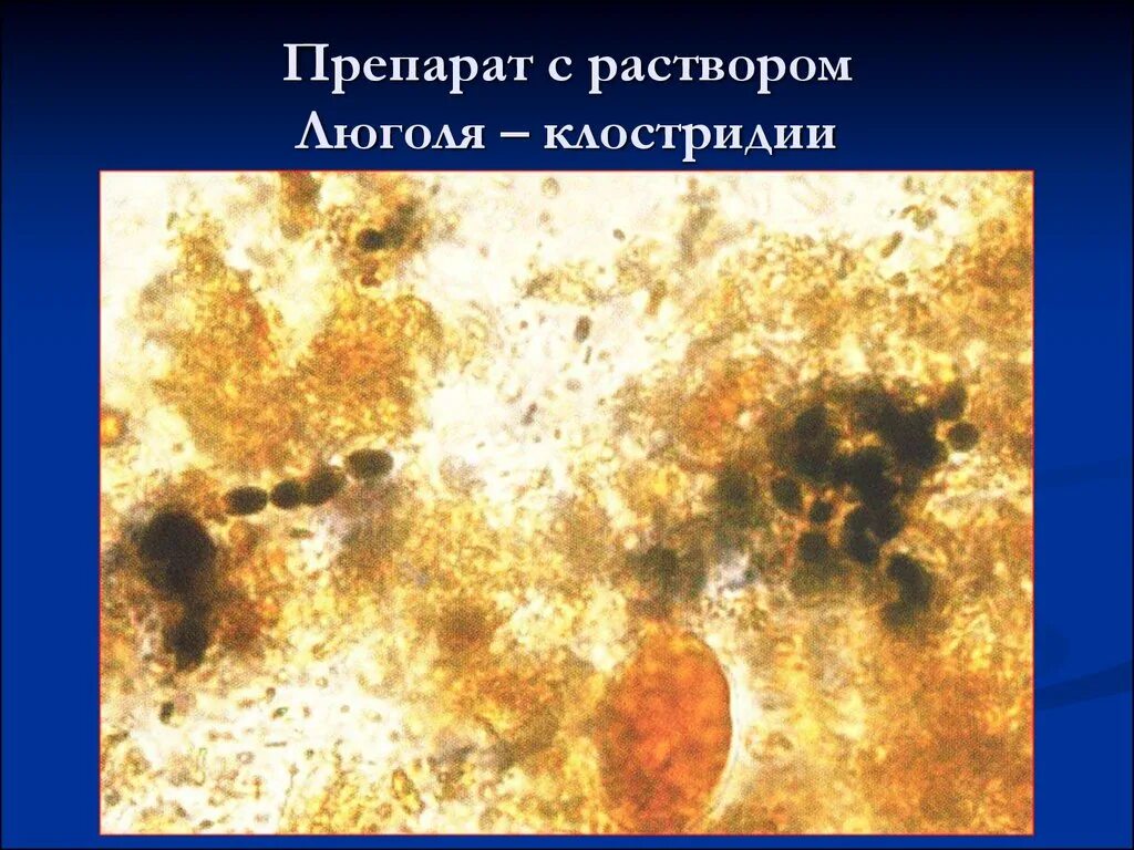 Растительная клетчатка в копрограмме. Микроскопия кала соединительная ткань. Микроскопия кала мышечные волокна.