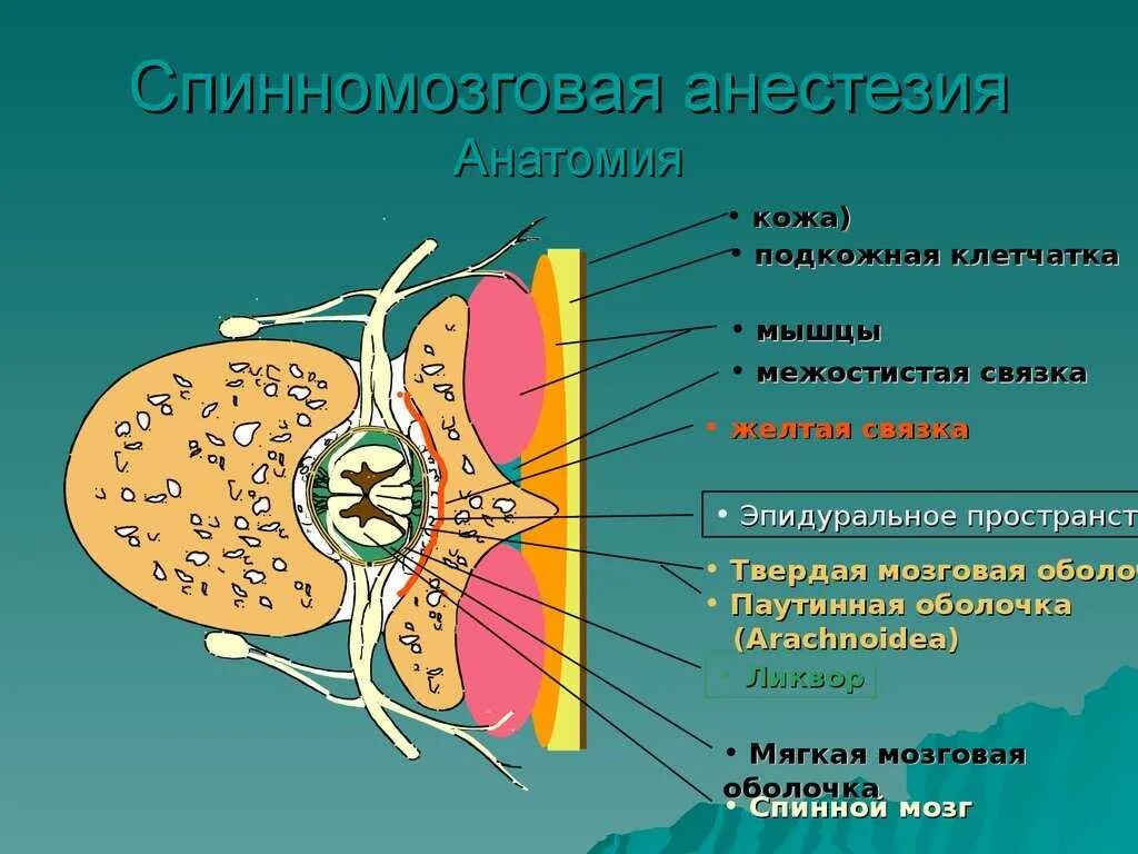 Эпидуральная спинная. Спинномозговая анестезия анатомия. Спинномозговая анестезия слои. Спинальная анестезия топографическая анатомия. Эпидуральная анестезия послойно.