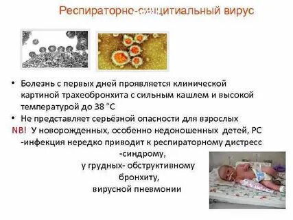 Респираторный вирус симптомы