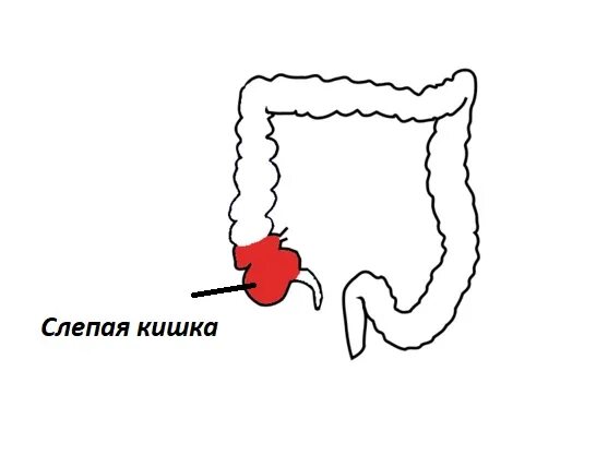 Слепая кишка рисунок. Купол слепой кишки схема. Толстая кишка (слепая и ободочная). Купол слепой кишки анатомия человека. Слепая кишка купол схема.