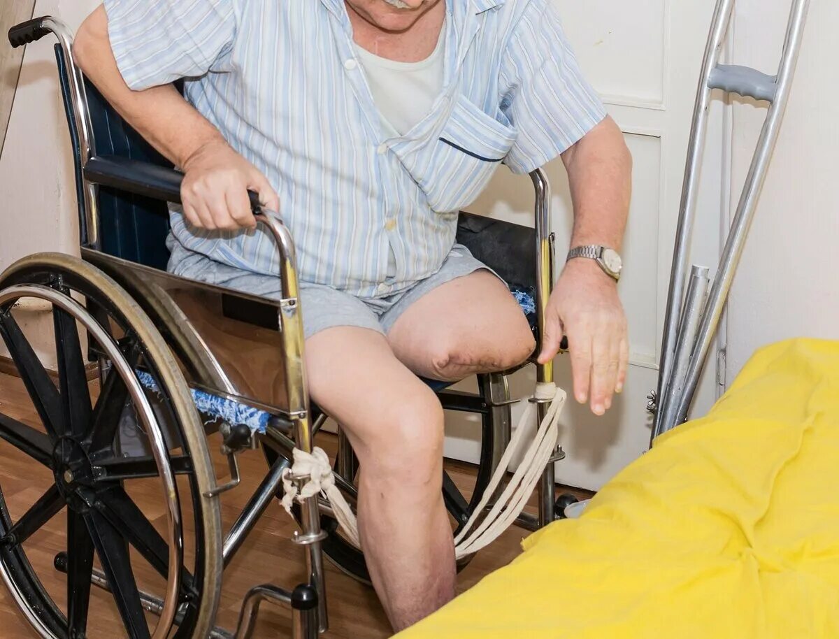 Пересадка инвалидов. Человек с ампутированной ногой.