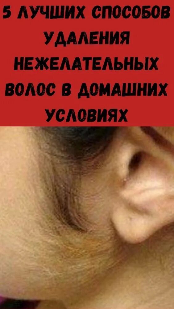 Как убрать волосы на лице навсегда. Методы избавления от нежелательных волос. удаляем нежелательные волосы. удалить навсегда нежелательные волосы.