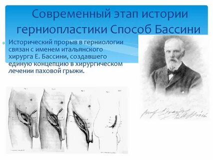 Паховая грыжа операция называется