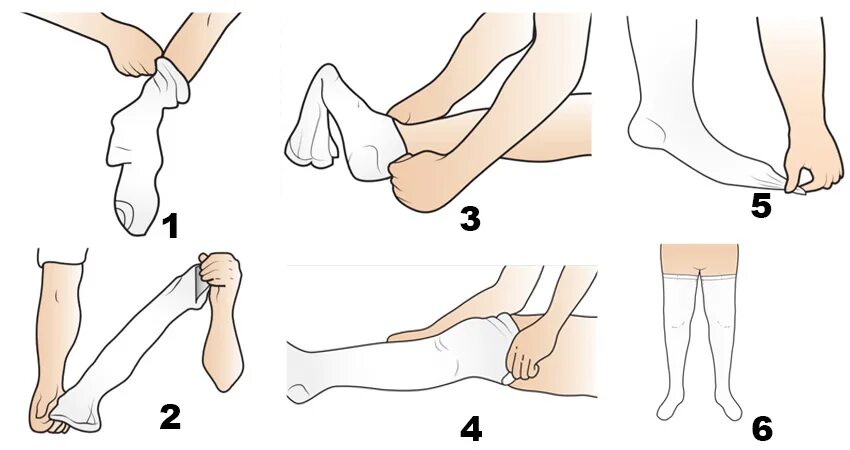 Как правильно надевать чулки перед операцией. Чулки перед операцией. Как одевать противоэмболические чулки. Как одевать компрессионные чулки 1 класса перед операцией. Противоэмболические чулки как носить.