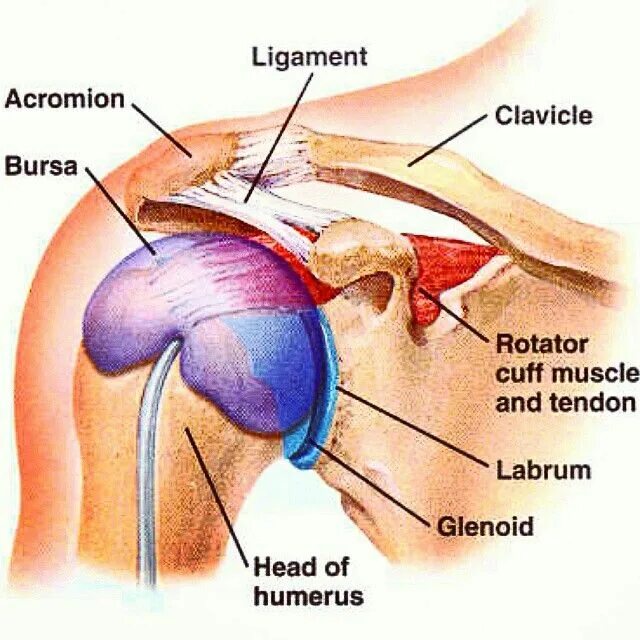 Болит рука при поднятии. Бурсит плечевого сустава. Бурсы плечевого сустава анатомия. Каменный бурсит плечевого сустава.