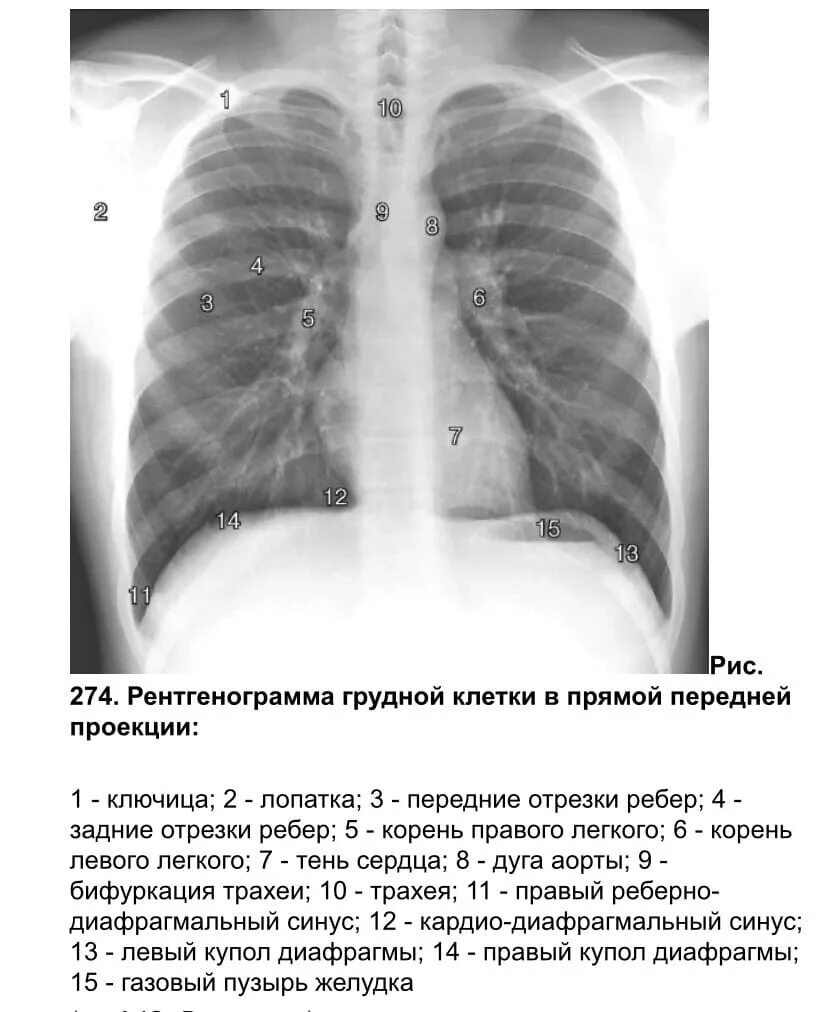 Рентген грудной клетки боковая проекция. Рентгенограмма грудной клетки в прямой проекции. Обзорная рентгенография грудной клетки в прямой проекции. Рентген органов грудной клетки в прямой проекции. Легкие в прямой проекции