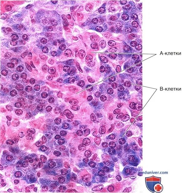 Клетки поджелудочной железы гистология. Островки Лангерганса поджелудочной железы гистология. Клетки островков Лангерганса гистология. Клетки островков Лангерганса поджелудочной железы гистология.
