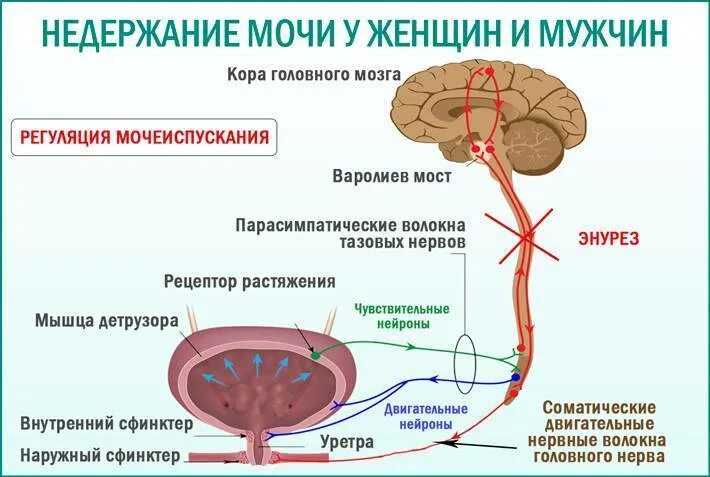 Недержание мочи у мужчин после 70 лечение. Схема процесса мочеиспускания. Причины недержания мочи. Недержание мочи у мужчин. Тотальное недержание мочи.