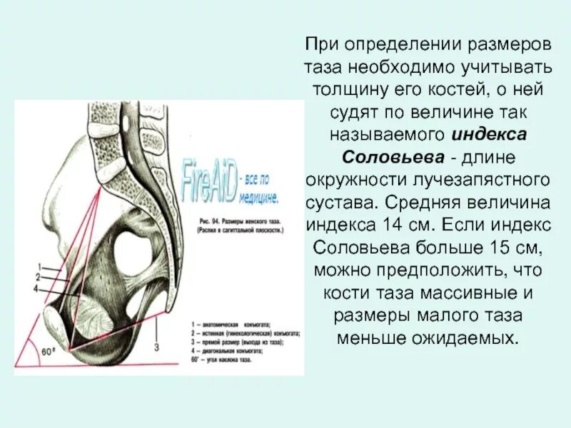 Индекс акушерство. Измерение обхвата запястья. Методы диагностики узкого таза. Измерение запястья индекс соловьева. Индекс соловьева и истинная конъюгата.