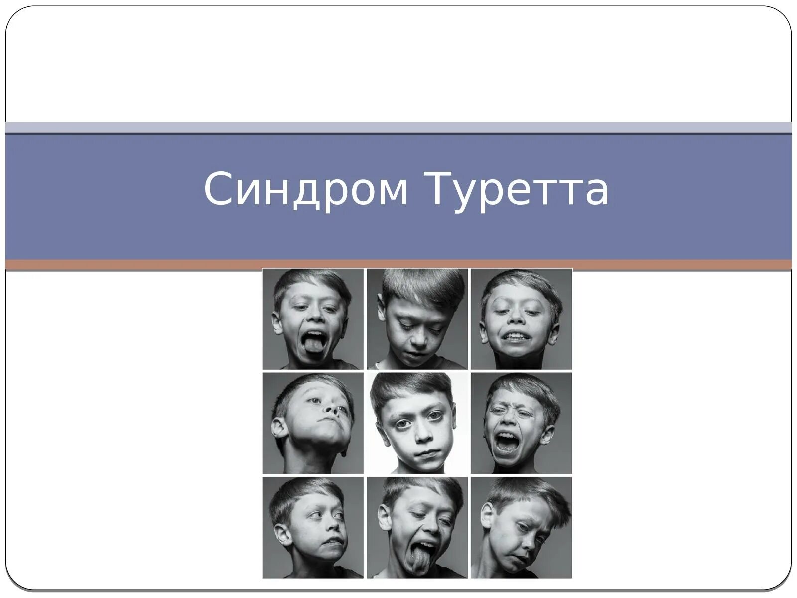 Синдром жиль де ля. Болезнь Жиля де Туретта. Синдром Турре а. Синдром Торетто. Синдом туиетта.