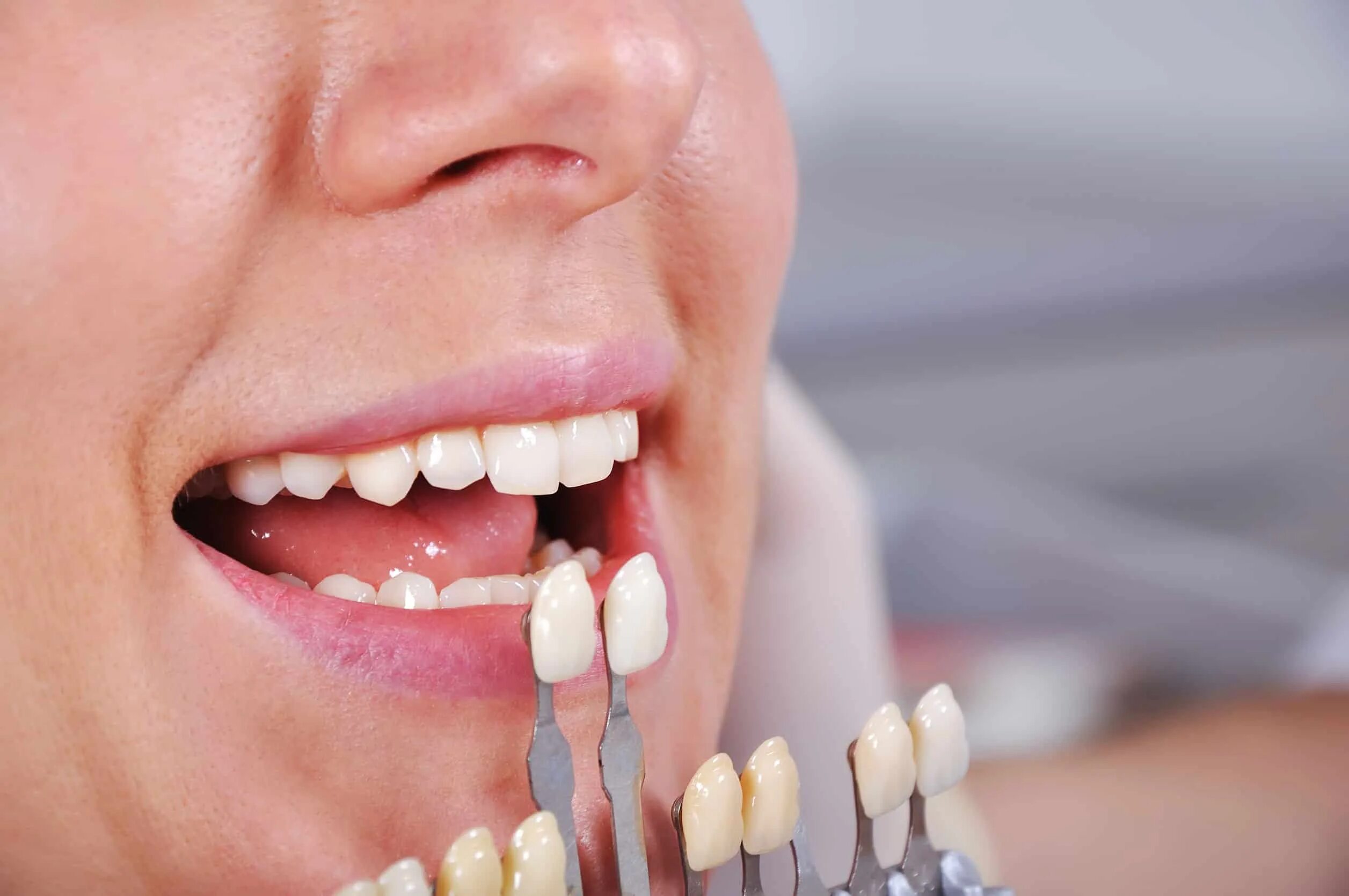 Искусственные зубы. Искусственные зубы для протезов. Красивые искусственные зубы. Подбор гарнитурных зубов.