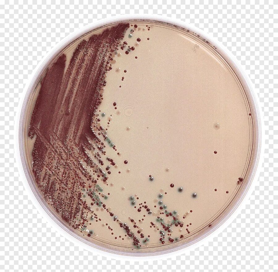 Кишечная палочка o157. Бактерия e.coli o157 h7. Хромогенный агар для сальмонелл. Сальмонелла на белом фоне. Среда для кишечной палочки