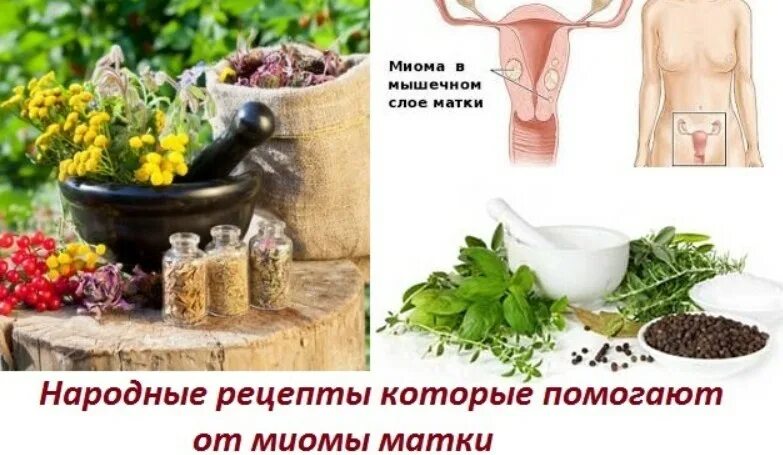 Как лечить миому матки без операции. Миома народные средства. миома матки народные средства. народные средства от миомы матки. народные средства от миомы матки народные средства.