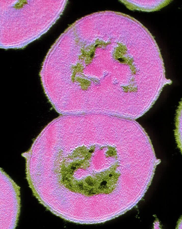 Streptococcus viridans у ребенка. Зеленящий стрептококк. стрептококк streptococcus viridans.