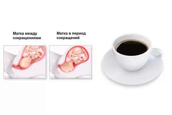 Пила кофе в беременность. Тонус при беременности во втором триместре. Тонус матки при беременности. Кофе поюри беременность. Нормотонус при беременности.