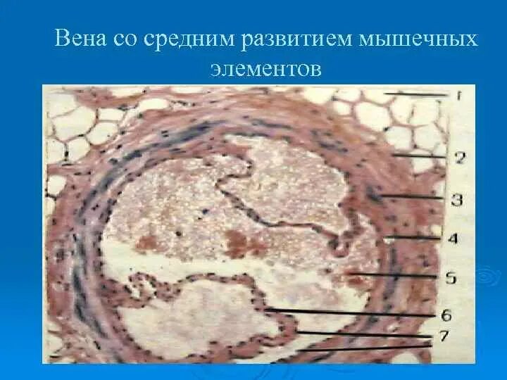Вены безмышечного типа примеры Картинки ВЕНСКИЙ ХАРАКТЕР
