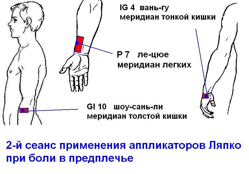 Лечение предплечья. Болит предплечье левой руки. Болит предплечье правой руки. Болит предплечье с внешней стороны.