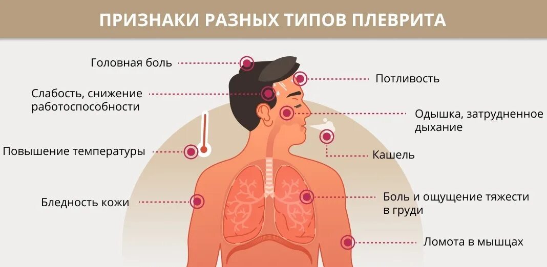 Признаки сильного кашля. Локализация боли в груди. Заболевания которые приводят к плевриту.