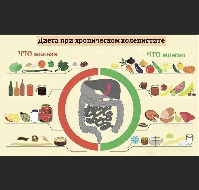 Диета при холистиците. Памятка по питанию при хроническом холецистите. Диета притхолицистите. Диетотерапия при хроническом холецистите. Памятка по питанию при остром холецистите.