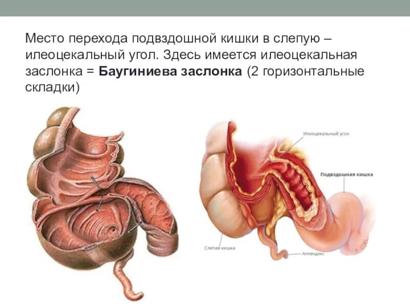 Подвздошная кишка анатомия. Баугиниева заслонка кишечника анатомия. Слепая кишка илеоцекального клапана. Илеоцекальный клапан толстой кишки. Илеоцекальный угол толстой кишки.