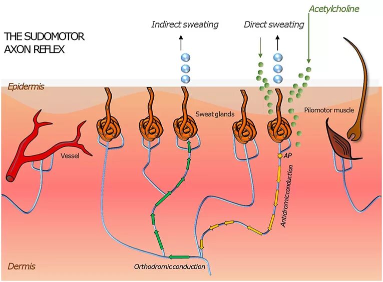 Аксон рефлекс. Quantitative sudomotor Axon Reflex. Аксон рефлекс физиология. Аксон рефлекс гистологии.