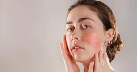 Soothe itching