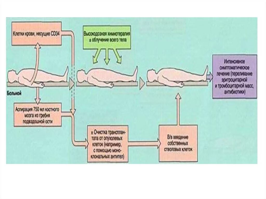 Пересадка костного мозга москва. Трансплантация костного мозга. Физиологические основы пересадки костного мозга.. Трансплантация костного мозга схема. Кондиционирование перед трансплантацией костного мозга.