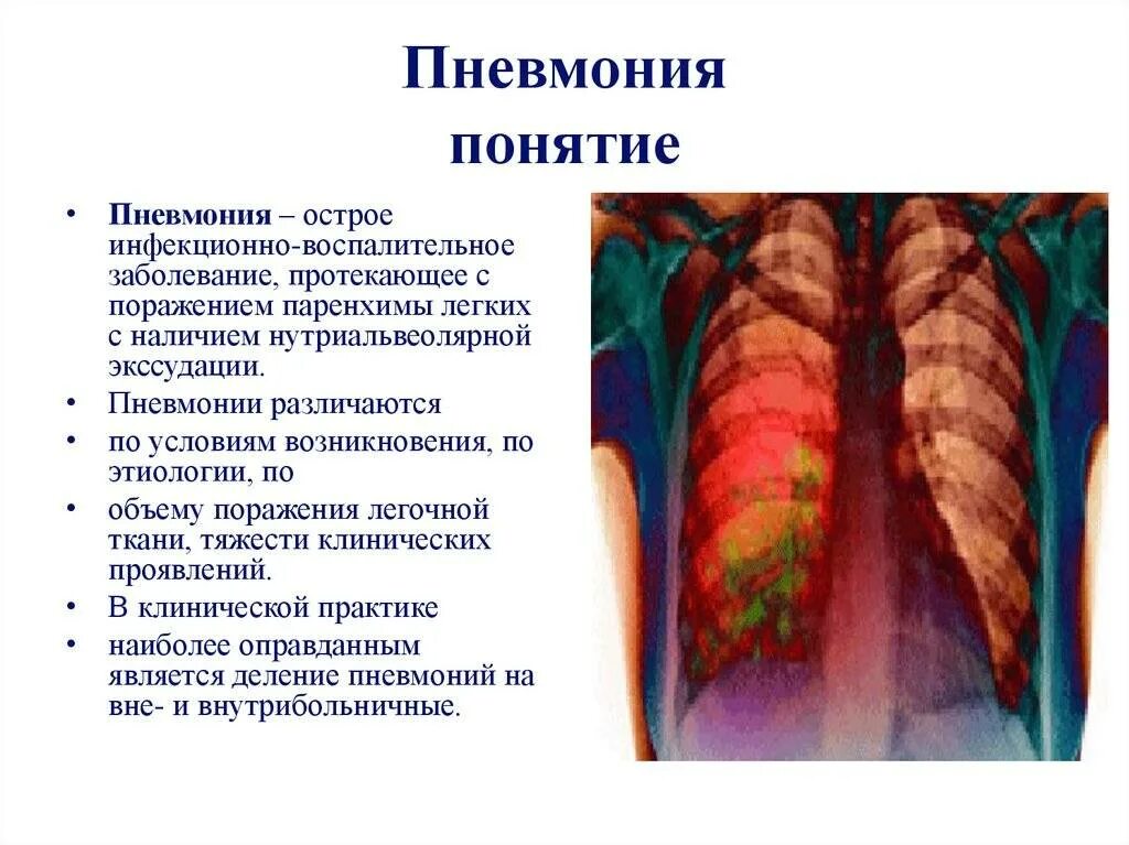 Можно ли при воспалении. Пневмония место поражения. Пневмония поражение легких.