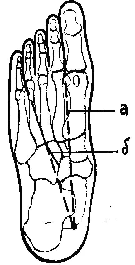Проекционная линия тыльной артерии стопы. Проекционные линии магистральных сосудов конечностей. Проекция тыльной артерии стопы. Проекционную линию тыльной артерии стопы (a. dorsalis pedis):. Линии подошвы