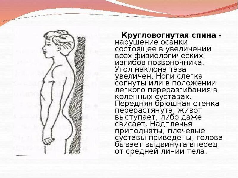 Вогнуто круглая спина. Вогнуто круглая спина. Вогнуто круглая спина. Осанка круглая спина. Кругловогнутая осанка рисунок.