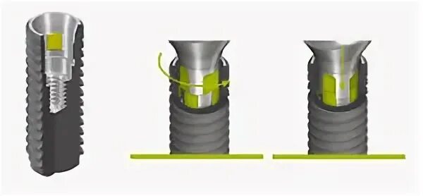 9. Абатмент мультиюнит штрауман. Straumann bone. Straumann bone. Импланты straumann slactive.